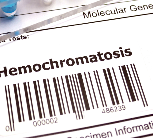 Hemochromatosis