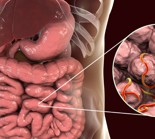 Intestinal Malabsorption